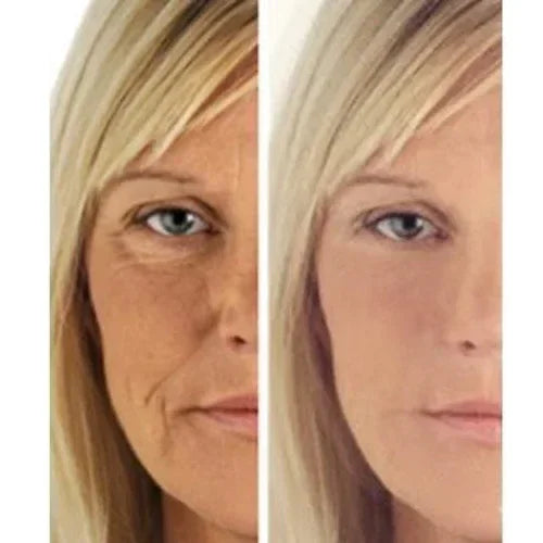 Before and after comparison showing visible wrinkle reduction using Age Perfect: Night Repair Cream + Vitamin C+ Serum.