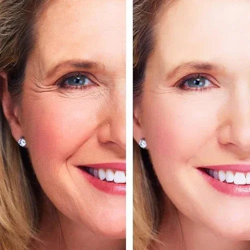 Before and after comparison of a woman's face showing reduced wrinkles using Age Perfect: Night Repair Cream + Vitamin C+ Serum.