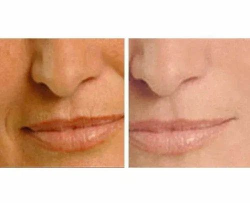 Before and after close-up of a woman's lower face showing reduced wrinkles using Age Perfect: Night Repair Cream + Vitamin C+ Serum.